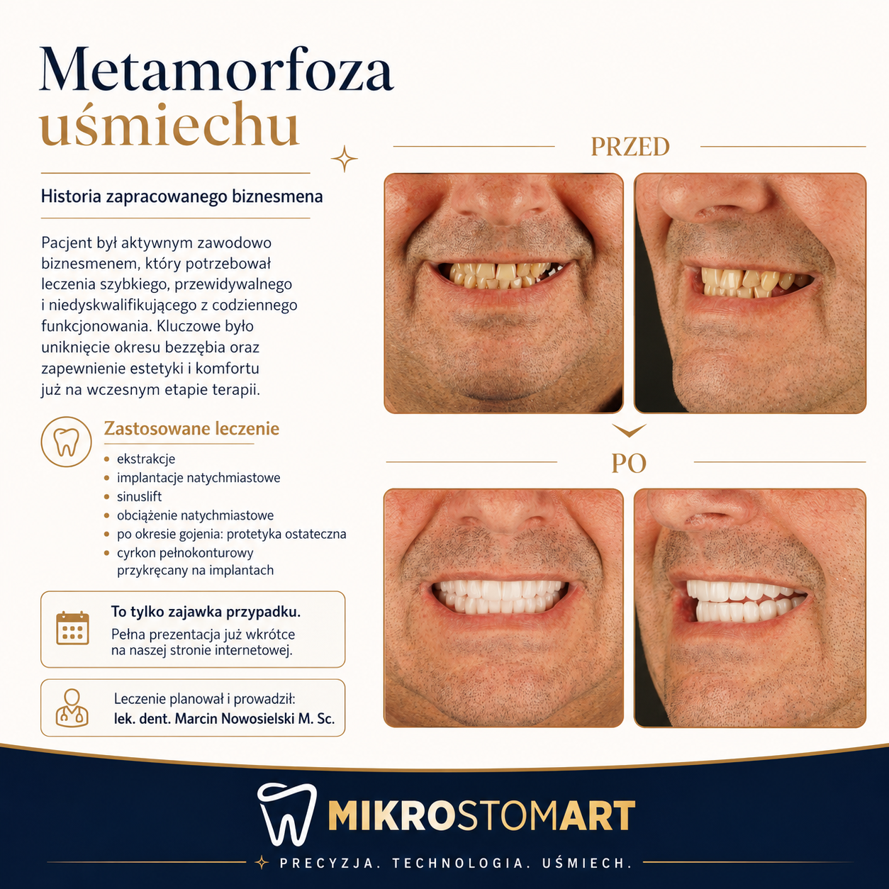 Metamorfoza uśmiechu — efekt przed i po leczeniu estetycznym