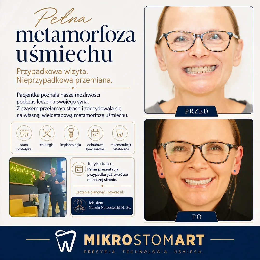 Historia pacjentki — pełna, wieloetapowa metamorfoza uśmiechu: stara protetyka, chirurgia, implantologia, odbudowa tymczasowa i rekonstrukcja ostateczna
